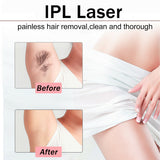 999999 Laser IPL Permanent Hair Removal Remover Face Body Leg Skin - Unisex